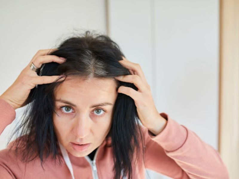 Menopause and Hair Loss